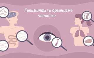 Токсокароз – причины и лечение